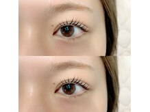 ビアス(VIAS)の雰囲気(瞳に影を作らないキレイなお目元に!)