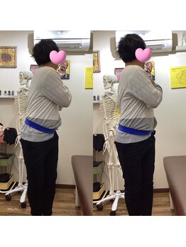 ヒデ整体院(Hide整体院)/猫背矯正骨盤矯正B/A肩こり腰痛