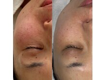 ギーク ラボ(GEEK LABO)の雰囲気(#セルマン #ワイコ水光ピール#ウィンバック)