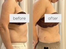 シエル(C i E L.)の雰囲気（痩身マシンbefore afterのお写真です☆）