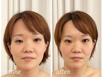 【バストアップ・小顔専門サロン】Cocon Priveの写真/鏡を見るたび嬉しくなる、小顔美人へ。