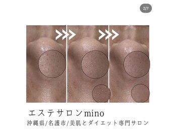 ミノ 美里大通り店(mino)/小鼻の黒ずみも改善☆