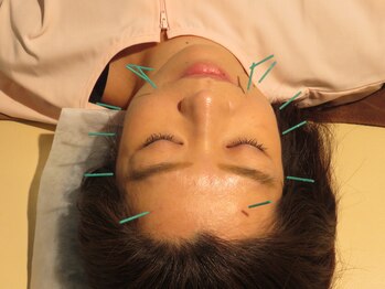 バナナ(Banana)/【整骨/鍼灸マッサージ】＃板橋