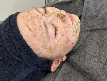 スナチュラル(Snatural)の写真/【新メニュー剥離式ハーブピーリング登場♪】あらゆるお肌悩みを解消します！