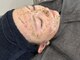 スナチュラル(Snatural)の写真/【新メニュー剥離式ハーブピーリング登場♪】あらゆるお肌悩みを解消します！