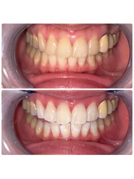 コナホワイトニング 神保町/セルフホワイトニング神保町