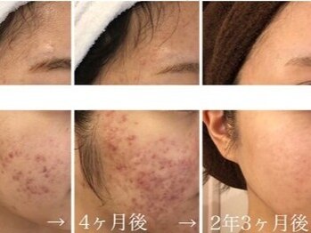 ビューティーサロン メイプルツリー/2025年地区別ファイナリスト受賞