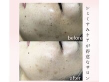 フルーヴ ルフレ(Fleuve Reflet)/敏感肌だから無理しないケア♪