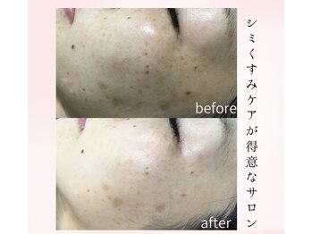 フルーヴ ルフレ(Fleuve Reflet)/敏感肌だから無理しないケア♪