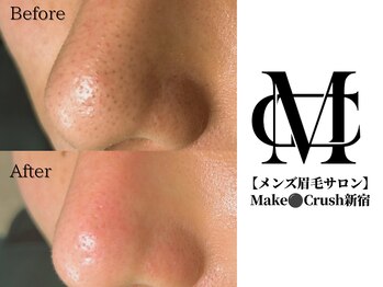 メイククラッシュ 新宿(Make Crush)の写真/眉毛スタイリング×毛穴洗浄でお顔のトータルケアが叶う♪男性専門店なので、お気軽にご相談ください♪