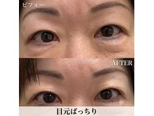 ラカン ビューティーアンドスキン(Lacan beauty&skin)の雰囲気(まつ毛パーマ/LEDエクステ/目元整えて毎日快適に)