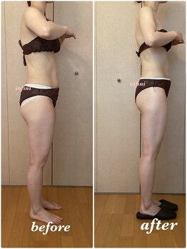 アンフィニ(infini)/ブライダル10回目(4ヶ月)