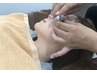 「肌質改善美容鍼」肌質改善のためのダーマ鍼で本来の美肌へ☆　￥3500