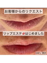 チーズ(CHI’S)/リップエステで潤う唇へ