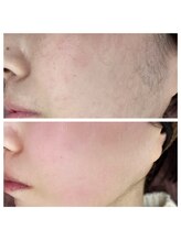 ヴェリー(Very)/フェイシャルワックス