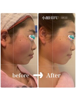 ルミナス(Luminous)/美肌＆小顔