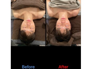 キヅク/H様 before→afterフェイシャル