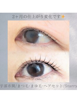 スターリー(Starry)/ラッシュアディクト