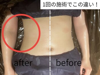 ビューティサロン チエ(chie)/1回の施術でこの効果！