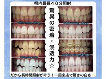 ホワイトニングショップ 明石大久保店