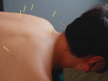 堀川鍼灸 接骨院