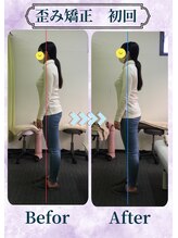 アミーゴ整体院/ビフォーアフター