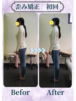 アミーゴ整体院/ビフォーアフター