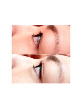 チャーミング(Charm Wink)/