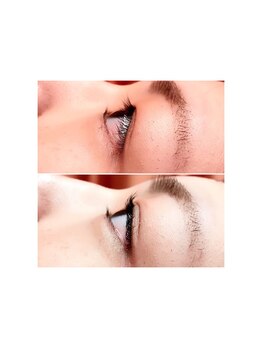 チャーミング(Charm Wink)/