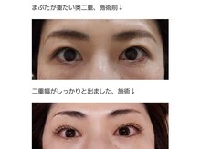 アロマスイーツ(AromaSweets)/まつげパーマ。まつ毛パーマ