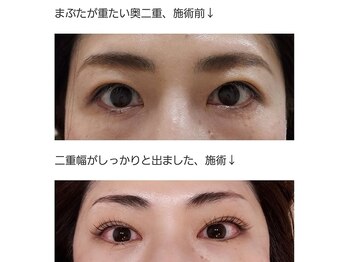 アロマスイーツ(AromaSweets)/まつげパーマ。まつ毛パーマ