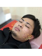 よつば鍼灸整骨院 春日院/美容鍼