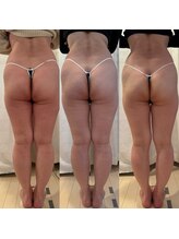 シェリモ(CHERIMO)/愛されヒップ2回目