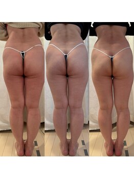 シェリモ(CHERIMO)/愛されヒップ2回目