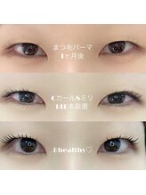 プラセル(placer)/&healthy