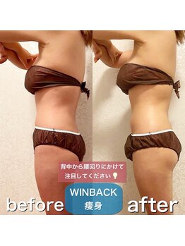 サロンデイジー(Salon Daisy)/WINBACK痩身☆施術一回