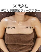 サンシャイン(Sunshine)/30代女性ビフォーアフター