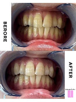 エクシアホワイトニング 王寺店/