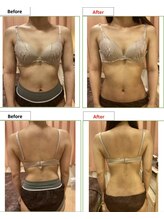 エステティック レイビス 銀座店(RAYVIS)/