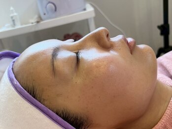 ビビッド(vivid)の写真/【判田】毛穴の黒ずみ・角栓をリセット！人気ナンバー1のマリムーブフェイシャルワックスで陶器肌/8900yen