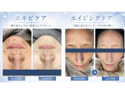 レベンディス(LEVENDIS)の写真