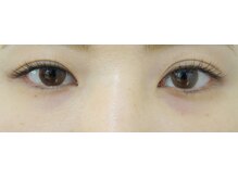 ビームズ トータルビューティー 西中島店(BeeMs Total Beauty)/【キュート】シングル80本