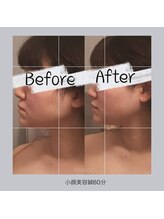 ティアラボ(TIARABO)/