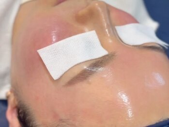 フローラル ビューティー(Floral-Beauty)/韓国美容★スーパージェクション