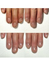 ネイル アンチュ(Nail Anchu)/自爪育成／二枚爪