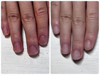 ヴェールリム(verl lim)/