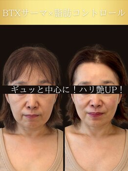 サロン ド ナース ユー ソナ(salon de nurse U.sona)/引き締まった肌はハリや弾力抜群