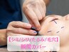 むくみスッキリ美容鍼【今月5名・小顔・むくみ・たるみ】￥8,800→初回￥4980