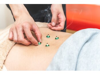 むさし鍼灸整骨院 針摺院