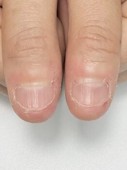 スイ(sui.)の写真/自爪育成をしながらネイルを楽しむ☆育成方法3種類からあなたに合う施術をご提案！健康的な美しい指先へ